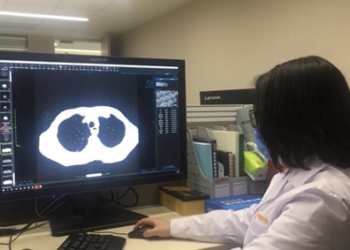 AI leads drive for Healthy China