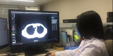 AI leads drive for Healthy China